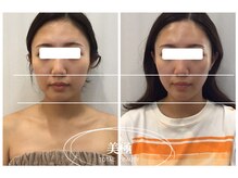 美極 銀座店/銀座/小顔コルギ/小顔矯正