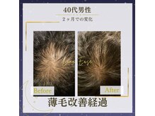 ルナイーズ(Luna Ease)の雰囲気（育毛促進は６ヶ月のみ。遠方の方や男性はオンラインコースも！）