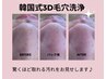 New《韓国式3D毛穴洗浄》驚くほど浮き上がる毛穴汚れに衝撃！¥14000→¥8000