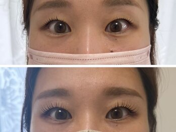 リラ(LILA)の写真/【ケラチンTr・コ-ティング・アイシャンプ-込】アイライン不要な目元で自分史上最大の瞳♪ナチュラル派も◎