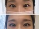 リラ(LILA)の写真/【ケラチンTr・コ-ティング・アイシャンプ-込】アイライン不要な目元で自分史上最大の瞳♪ナチュラル派も◎