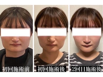 クリーム 金沢店(Cream)