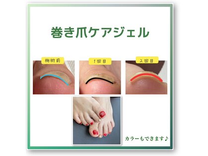 ミコ(.mico)の写真