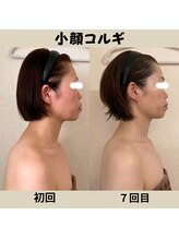 リーブル(LIBRE)/小顔コルギ　７回