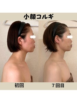 リーブル(LIBRE)/小顔コルギ 7回