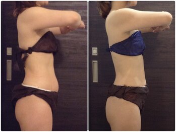 美容整体ウェリナ あま甚目寺院/小顔矯正/骨盤矯正/美脚サロン