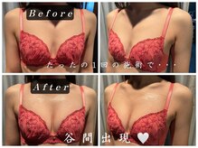 パフューム(Perfume)/