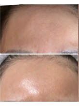 マリエンドリー/