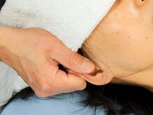 あおば接骨院【整体・はり・美容鍼】/整体/頭蓋骨