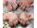 ちび爪さんビフォーアフター