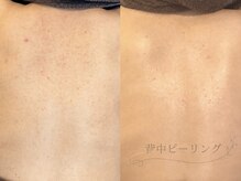 LILY E の雰囲気（自分でケアしにくいお背中はお任せ下さい。ブライダル前にも。）