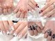 リノネイル(Rino-nail)の写真
