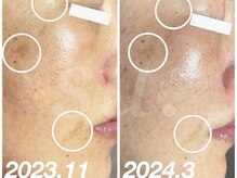 スウ(su:)/4ヶ月後には…☆