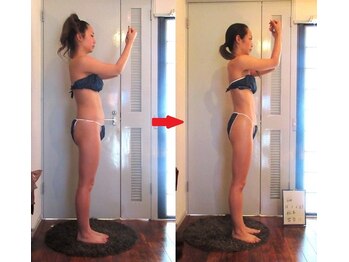 痩身 セル脂肪専門 スタイルデザイン/施術6回★2ヶ月10日★綺麗痩せ