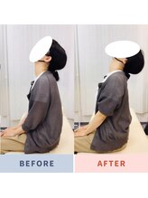 ナオル整体 三鷹院(NAORU整体)/40代女性施術事例【頚部後屈】