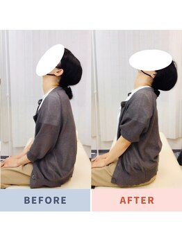 ナオル整体 三鷹院(NAORU整体)/40代女性施術事例【頚部後屈】