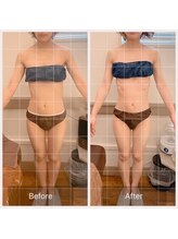 カルナ(carna)/《2か月計4回》2週間に1回