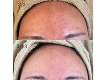 オリエンス(oriens)の雰囲気（ハーブで皮脂バランスの調整も！）