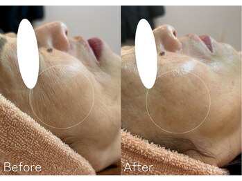 ミュー 多治見店(mieux)/お客様の変化