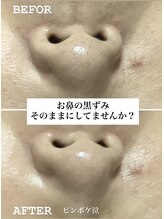 コルッソ(CoLusson.)/毛穴の黒ずみすっきり解消！