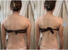 サロンハート(Salon Heart)