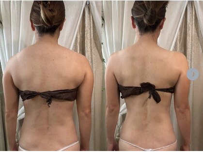 サロンハート(Salon Heart)の写真