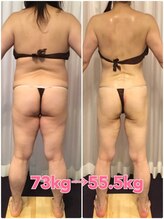 ボディエステティック アクアオーラ 富山店/変化がすごい