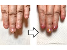 アプリコットネイル(apricot nail)/自爪育成