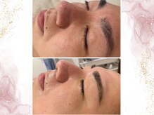 ウェリナポノビューティサロン(welina pono beauty salon)/《小顔/毛穴/脱毛》