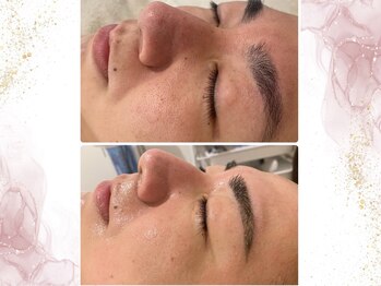 ウェリナポノビューティサロン(welina pono beauty salon)/《小顔/毛穴/脱毛》