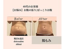 アキナイ(akinai)の雰囲気（《お悩み》お腹の張り/ぽっこりお腹）