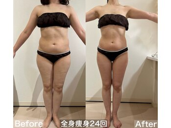 ヴィクシア(VIXIA)/痩身90分