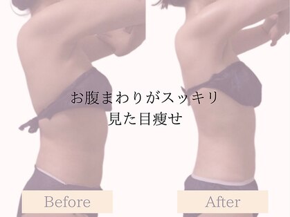 ヨサパーク ミューズ(YOSA PARK MUSE)の写真