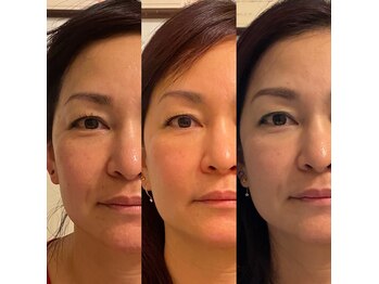 ブリーズ(Breeze)