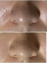 マリエンドリー/