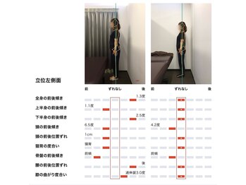 女性専用整体サロン　ベル 岩国店/ 【50代】姿勢Before After