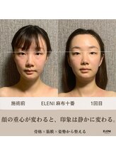 エレーニ 麻布十番(ELENI)/マスクを外すのが楽しみに