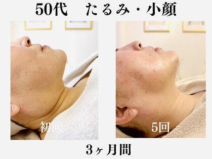 ランティル(l’until)の写真