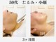 ランティル(l’until)の写真
