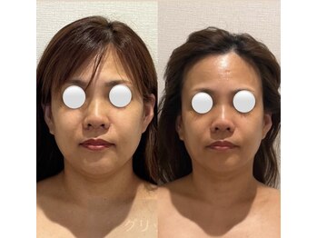 エレミュー 烏丸(Elemue.)の写真/【結果主義×持続力×根本改善】多くの方が効果を即日実感で口コミ高評価★