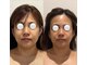 エレミュー 烏丸(Elemue.)の写真/【結果主義×持続力×根本改善】多くの方が効果を即日実感で口コミ高評価★