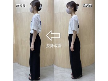 アンド リラクゼーション フレイ整骨院(&Relaxation)/反り腰/猫背/骨盤の歪み(整体)