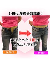 さらさ整骨院/産後骨盤矯正ビフォーアフター