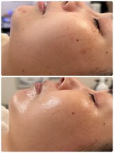 ヘアメイク エステサロン クラシカ(hairmake esthe salon clasika)/ＶＯＳサロンケア