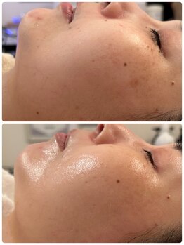 ヘアメイク エステサロン クラシカ(hairmake esthe salon clasika)/ＶＯＳサロンケア