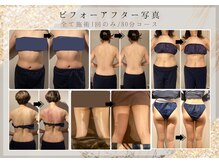 サロン ド ステラ(Salon de Stella)/ビフォーアフター