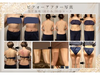 サロン ド ステラ(Salon de Stella)/ビフォーアフター