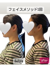 メローワックス 宮崎店(MELLOW WAX)/1回の施術でここまで変化♪