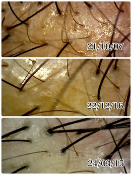 ミルラ(myrrh)/50代白髪染め頭皮エイジングケア