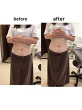 ジョワイユ(Joyeux)/腸の位置でお腹は変わる